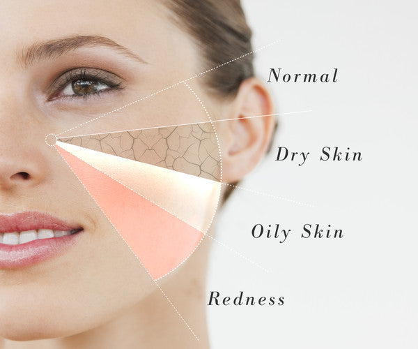 How to Determine Your Skin Type – Ayelet®